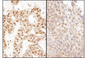 Immunohistochemistry (IHC) image for anti-Ubiquitin (Ub) (AA 1-50) antibody (ABIN7449404)