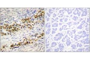 Immunohistochemistry analysis of paraffin-embedded human ovary, using Akt (Phospho-Ser246) Antibody. (AKT1 抗体  (pSer246))