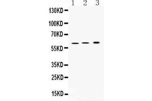 Western blot analysis of ATP4B expression in rat stomach extract ( Lane 1), mouse stomach extract ( Lane 2) and SGC7901 whole cell lysates ( Lane 3). (ATP4b 抗体  (N-Term))