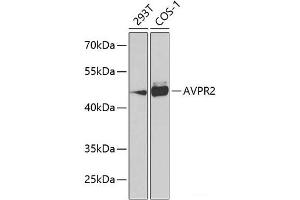 Western blot analysis of extracts of various cell lines using AVPR2 Polyclonal Antibody at dilution of 1:1000. (AVPR2 抗体)