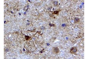 ABIN2562804 (2µg/ml) staining of paraffin embedded Human Cerebellum. (GFAP 抗体  (C-Term))