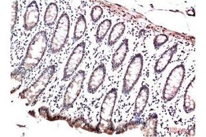 Immunohistochemical analysis of paraffin-embedded Human Colon Carcinoma Tissue using HP-1γ Mouse mAb diluted at 1:200 (CBX3 抗体)