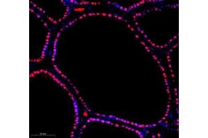 Immunofluorescence of paraffin embedded mouse prostate using CUX2 (ABIN7073607) at dilution of 1:1000 (300x lens) (CUX2 抗体)
