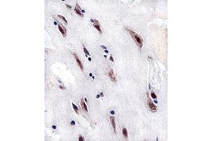Immunohistochemical analysis of paraffin-embedded H. (CSNK2A1/CK II alpha 抗体  (AA 250-284))