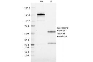 SDS-PAGE Analysis of Purified, BSA-Free CD19 Antibody (clone CVID3/155).