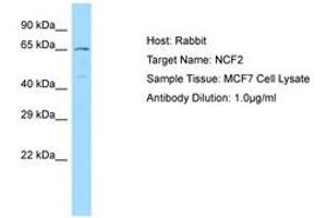 Image no. 1 for anti-Neutrophil Cytosolic Factor 2 (NCF2) (AA 429-478) antibody (ABIN6749984) (NCF2 抗体  (AA 429-478))