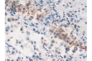 Detection of MVP in Human Lung Tissue using Polyclonal Antibody to Major Vault Protein (MVP) (MVP 抗体  (AA 2-272))