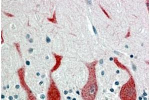 RARA polyclonal antibody  (4 ug/mL) staining of paraffin embedded human cerebellum.