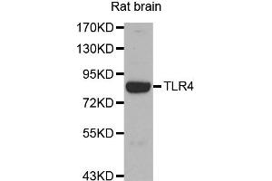 Western blot analysis of Rat brain tissue lysate using TLR4 antibody. (TLR4 抗体)