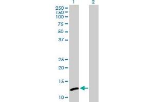 Western Blot analysis of C1orf38 expression in transfected 293T cell line by C1orf38 MaxPab polyclonal antibody. (C1orf38 抗体  (AA 1-132))