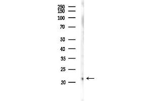 anti-SFT2 Domain Containing 3 (SFT2D3) (N-Term) antibody