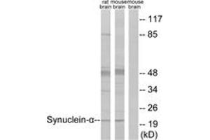 Western blot analysis of extracts from rat brain/mouse brain cells, using Synuclein-alpha (Ab-125) Antibody. (SNCA 抗体  (AA 86-135))