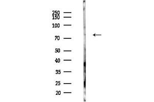 anti-Glycogen Synthase 2, Liver (GYS2) (C-Term) antibody