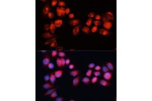 Immunofluorescence analysis of HeLa cells using  antibody (ABIN7265735) at dilution of 1:100 (40x lens). (ABCB7 抗体  (AA 503-753))