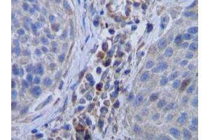 Image no. 1 for anti-Colony Stimulating Factor 1 (Macrophage) (CSF1) antibody (ABIN465551) (M-CSF/CSF1 抗体)