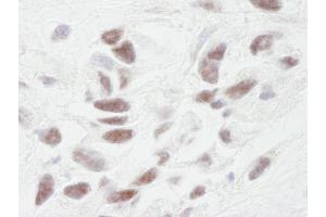 Immunohistochemistry (IHC) image for anti-Protein Phosphatase 1, Regulatory (Inhibitor) Subunit 10 (PPP1R10) (AA 350-400) antibody (ABIN7448729)
