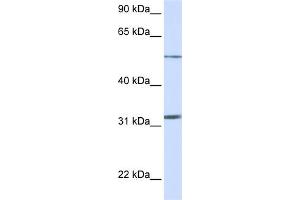 WB Suggested Anti-SLC35A5 Antibody Titration:  0. (SLC35A5 抗体  (N-Term))