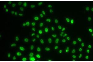 Immunofluorescence analysis of MCF-7 cells using PHIP Polyclonal Antibody (PHIP 抗体)
