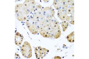 Immunohistochemistry of paraffin-embedded human stomach using NUMA1 antibody. (NUMA1 抗体)