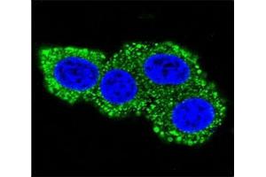 Confocal immunofluorescent analysis of CD28 antibody with HeLa cells followed by Alexa Fluor 488-conjugated goat anti-rabbit lgG (green).