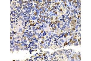 Immunohistochemistry of paraffin-embedded Rat spleen using UBE2V2 Polyclonal Antibody at dilution of 1:100 (40x lens). (UBE2V2 抗体)