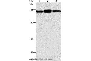Western blot analysis of Mouse brain and skin tissue, 293T cell , using CAPN2 Polyclonal Antibody at dilution of 1:200 (Calpain 2 抗体)