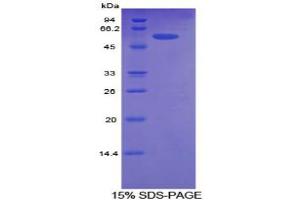 SDS-PAGE analysis of Human ALCAM Protein. (CD166 蛋白)
