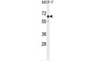 CO027 Antibody (C-term) western blot analysis in MCF-7 cell line lysates (35µg/lane). (C15orf27 抗体  (C-Term))