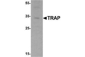 Western blot analysis of TRAP in mouse brain tissue lysate with TRAP Antibody  at 1 ug/mL. (ACP5 抗体  (C-Term))