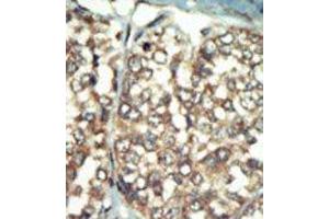 Image no. 2 for anti-Phosphatidylinositol 4-Kinase Type 2 beta (PI4K2B) (C-Term) antibody (ABIN360474) (PI4K2B 抗体  (C-Term))
