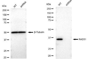 Western blotting analysis using RAD51 antibody (ABIN7798366).