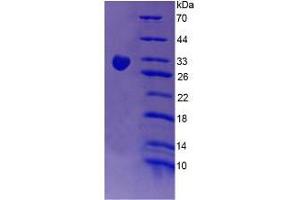SDS-PAGE analysis of Human CR1 Protein. (CD35 蛋白)