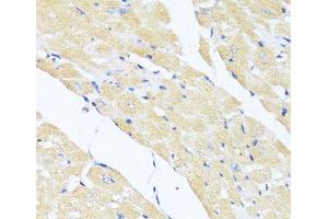Immunohistochemistry of paraffin-embedded Mouse heart using EIF2S1 Polyclonal Antibody at dilution of 1:100 (40x lens). (EIF2S1 抗体)