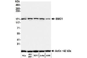 Western Blotting (WB) image for anti-Structural Maintenance of Chromosomes 1A (SMC1A) (C-Term) antibody (ABIN7455193)