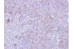 IHC-P Image Immunohistochemical analysis of paraffin-embedded DLD-1 xenograft , using SLC26A8, antibody at 1:500 dilution. (SLC26A8 抗体  (C-Term))