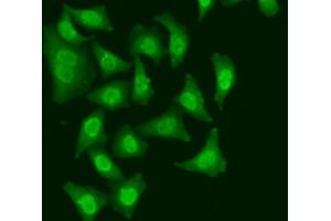 Immunofluorescence analysis of A549 cells using CDC5L antibody. (CDC5L 抗体)