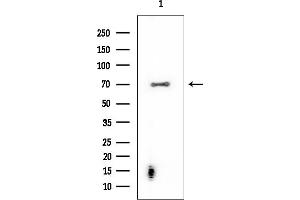 Western blot analysis of lysates from EC304 cells, using ENaC gamma Mouse Monoclonal Antibody at 1/1000 dilution.