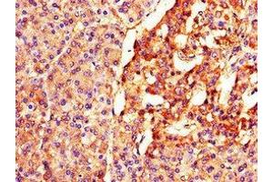 Immunohistochemistry of paraffin-embedded human pancreatic tissue using ABIN7152495 at dilution of 1:100 (BTRC 抗体  (AA 397-448))