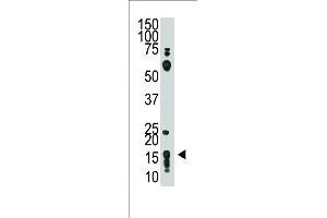 The anti-THY1 (N-term) Pab (ABIN388803 and ABIN2839126) is used in Western blot to detect THY1 in HL60 cell lysate. (CD90 抗体  (N-Term))
