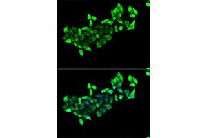 Immunofluorescence analysis of HeLa cells using FLOT1 antibody. (Flotillin 1 抗体)