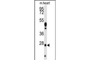 Western blot analysis of anti-WDYHV1 Antibody Pab in mouse heart tissue lysates (35ug/lane). (WDYHV1 抗体  (AA 106-136))
