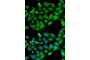 Immunofluorescence analysis of MCF-7 cells using RBBP7 antibody. (RBBP7 抗体)