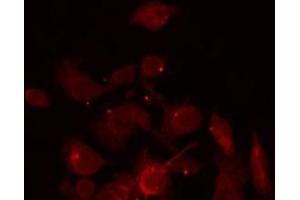 ABIN6266928 staining Hela by IF/ICC. (ZNF187 抗体  (Internal Region))