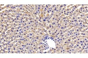 Detection of OSMR in Rat Liver Tissue using Polyclonal Antibody to Oncostatin M Receptor (OSMR) (Oncostatin M Receptor 抗体  (AA 503-749))