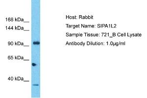 Host: Rabbit Target Name: SIPA1L2 Sample Tissue: Human 721_B Whole Cell Antibody Dilution: 1ug/ml (SIPA1L2 抗体  (C-Term))