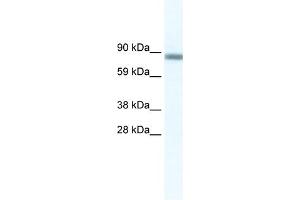 WB Suggested Anti-GATAD2A Antibody Titration:  2. (GATAD2A 抗体  (N-Term))