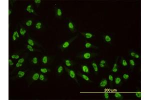 Immunofluorescence of monoclonal antibody to AKAP8 on HeLa cell. (AKAP8 抗体  (AA 551-662))