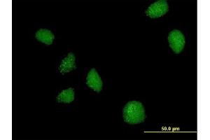 Immunofluorescence of purified MaxPab antibody to C21orf7 on HeLa cell.