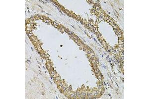 Immunohistochemistry (Paraffin-embedded Sections) (IHC (p)) image for anti-Phosphoinositide-3-Kinase, Catalytic, alpha Polypeptide (PIK3CA) (AA 401-600) antibody (ABIN3020829)