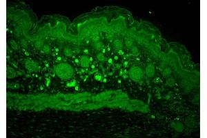 Immunohistochemistry analysis using Rabbit Anti-HSP110 Polyclonal Antibody . (HSPA4 抗体  (PerCP))